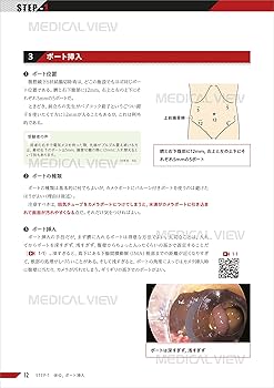 技術認定試験突破のためのラパ S 中山裕次郎　技術認定医 商品詳細ページ | メディカルブックセンター